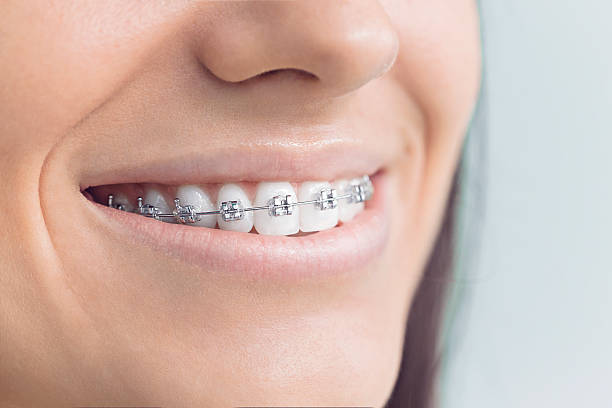 Dental Inlays and Onlays in Buena, NJ